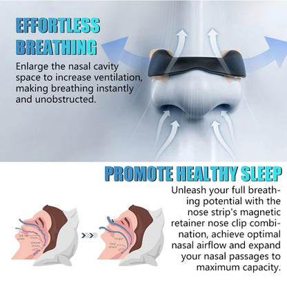 Eicgo Magnetic Nasal Dilator Strips